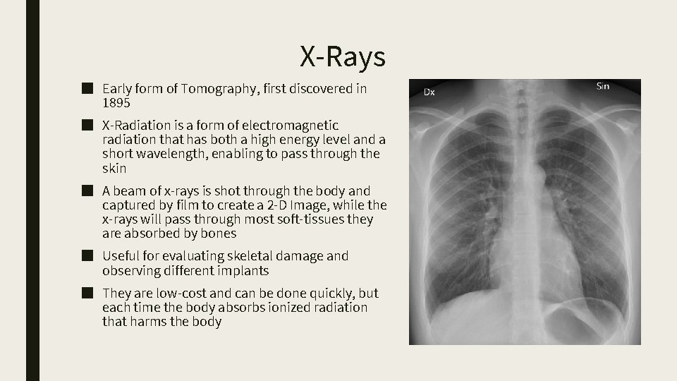 X-Rays ■ Early form of Tomography, first discovered in 1895 ■ X-Radiation is a