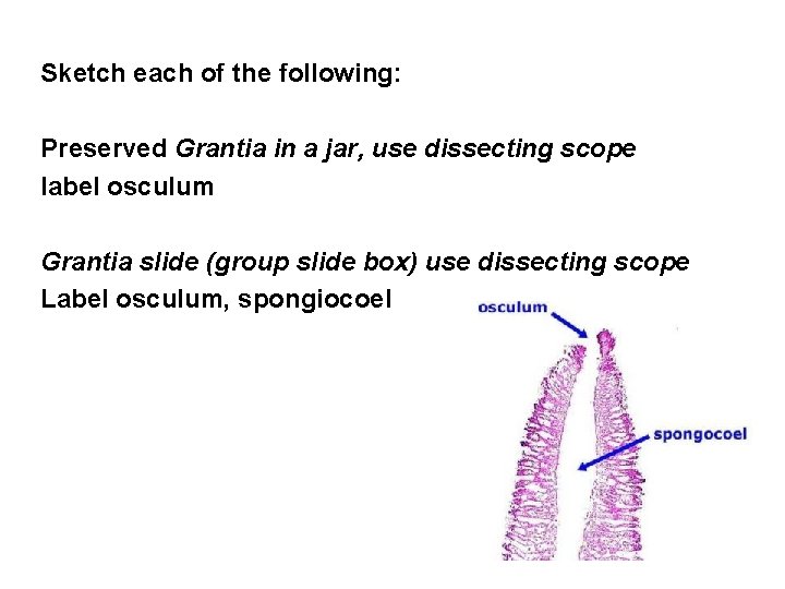 Sketch each of the following: Preserved Grantia in a jar, use dissecting scope label
