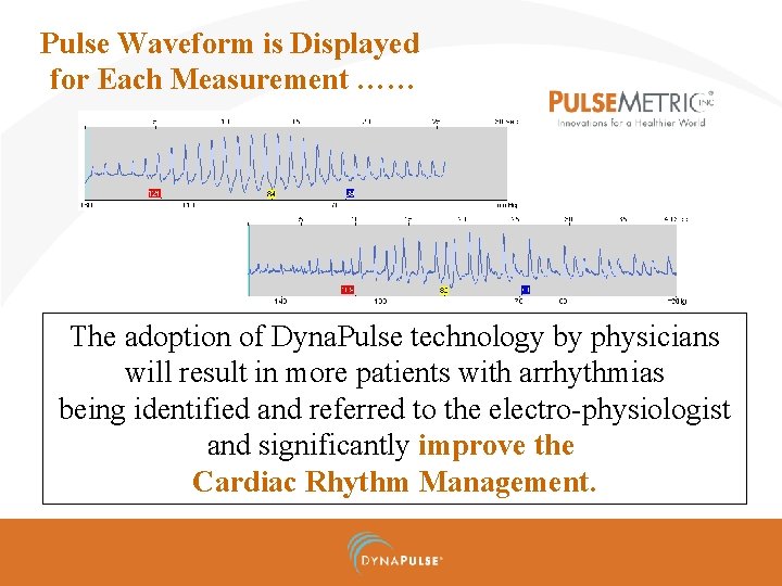 Pulse Waveform is Displayed for Each Measurement …… The adoption of Dyna. Pulse technology