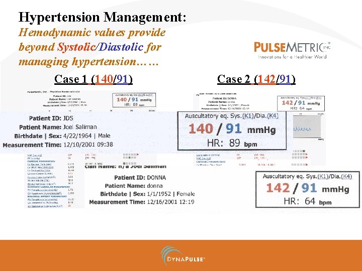 Hypertension Management: Hemodynamic values provide beyond Systolic/Diastolic for managing hypertension…… Case 1 (140/91) Case