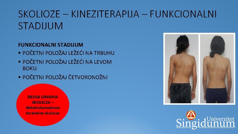 SKOLIOZE – KINEZITERAPIJA – FUNKCIONALNI STADIJUM § POČETNI POLOŽAJ LEŽEĆI NA TRBUHU § POČETNI