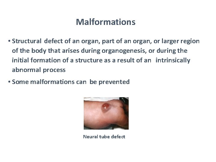 Malformations • Structural defect of an organ, part of an organ, or larger region