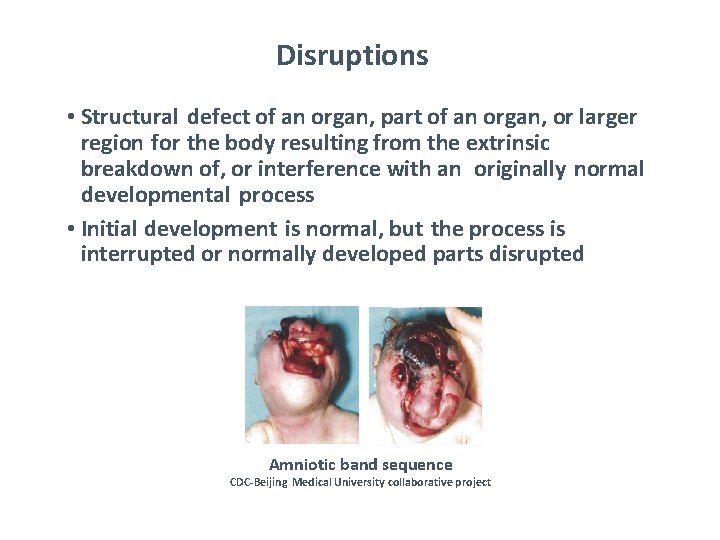 Disruptions • Structural defect of an organ, part of an organ, or larger region