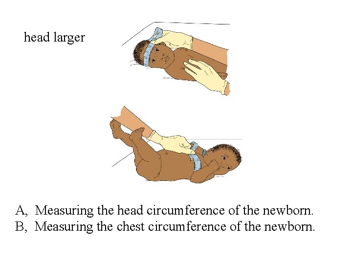 head larger A, Measuring the head circumference of the newborn. B, Measuring the chest