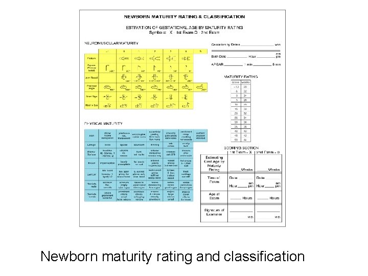 Newborn maturity rating and classification 