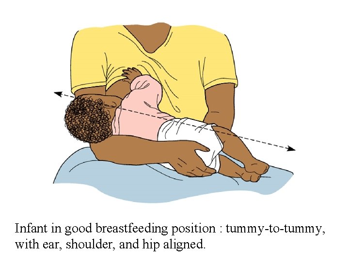 Infant in good breastfeeding position : tummy-to-tummy, with ear, shoulder, and hip aligned. 