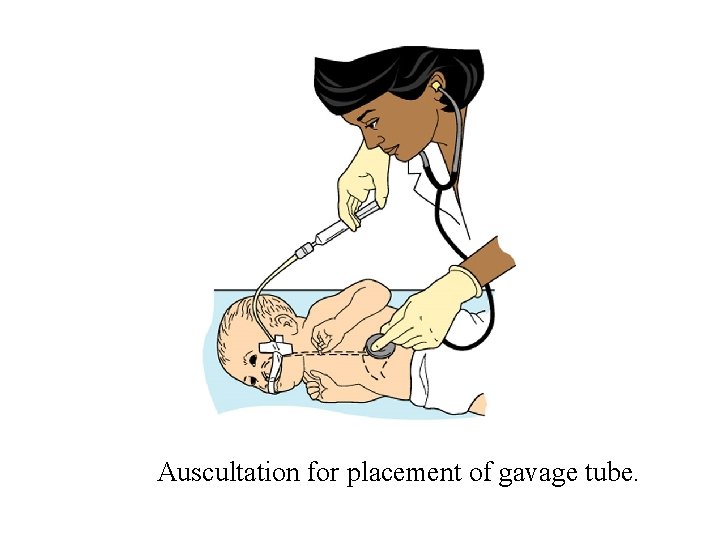 Auscultation for placement of gavage tube. 