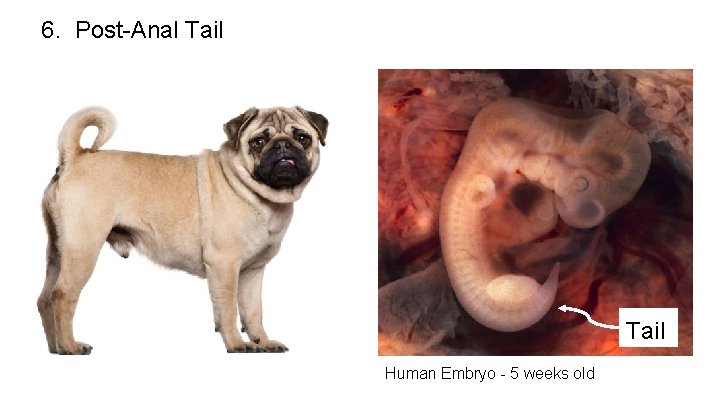 6. Post-Anal Tail Human Embryo - 5 weeks old 