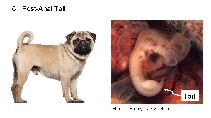 6. Post-Anal Tail Human Embryo - 5 weeks old 6. Post-Anal Tail Human Embryo - 5 weeks old