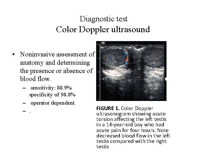 Diagnostic test Color Doppler ultrasound • Noninvasive assessment of anatomy and determining the presence