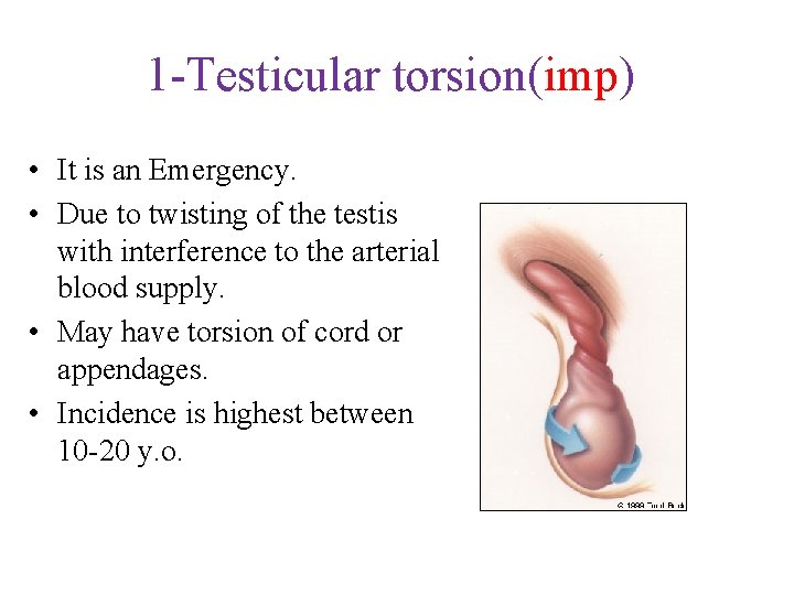 1 -Testicular torsion(imp) • It is an Emergency. • Due to twisting of the