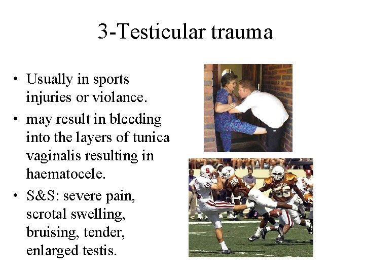 3 -Testicular trauma • Usually in sports injuries or violance. • may result in