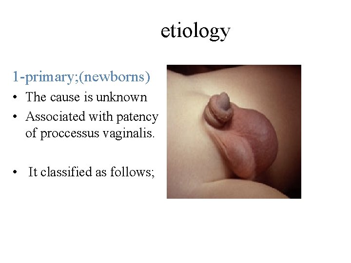 etiology 1 -primary; (newborns) • The cause is unknown • Associated with patency of