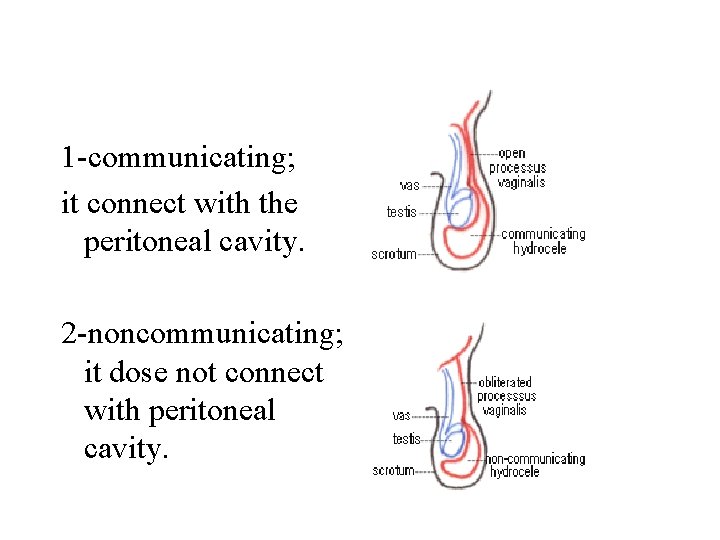 1 -communicating; it connect with the peritoneal cavity. 2 -noncommunicating; it dose not connect