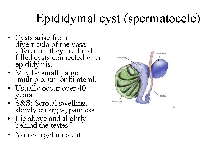 Epididymal cyst (spermatocele) • Cysts arise from diverticula of the vasa efferentia, they are