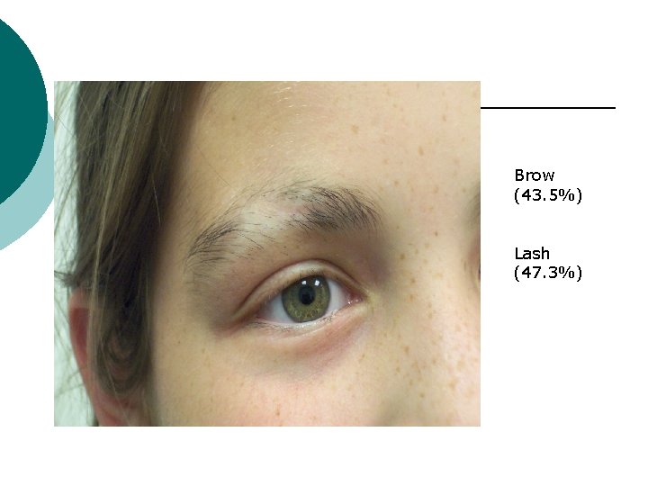 Brow (43. 5%) Lash (47. 3%) 