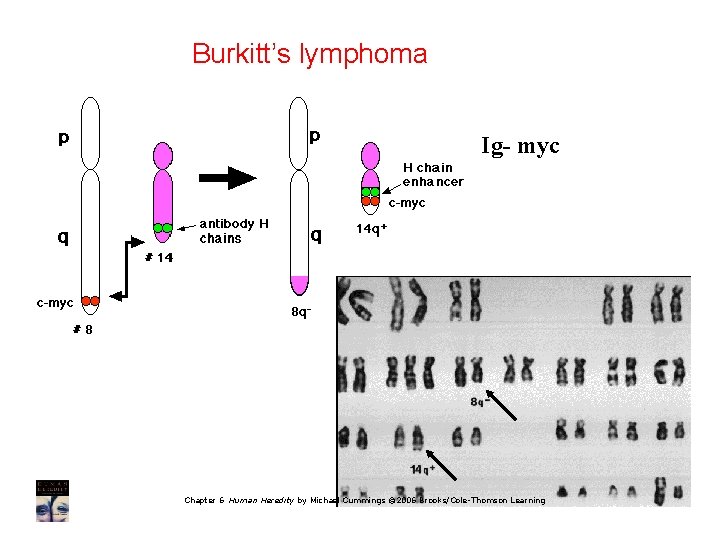 Burkitt’s lymphoma Ig- myc Chapter 6 Human Heredity by Michael Cummings © 2006 Brooks/Cole-Thomson