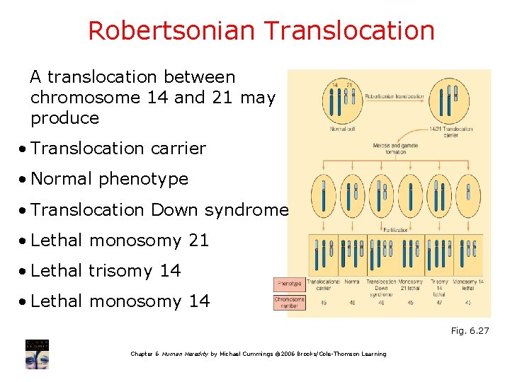 Robertsonian Translocation A translocation between chromosome 14 and 21 may produce • Translocation carrier