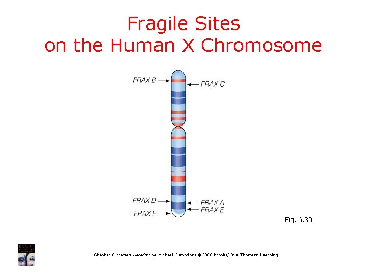 Fragile Sites on the Human X Chromosome Fig. 6. 30 Chapter 6 Human Heredity