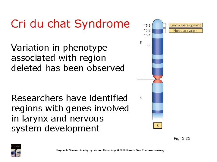 Cri du chat Syndrome Variation in phenotype associated with region deleted has been observed