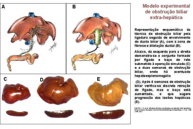 A A B B Modelo experimental de obstrução biliar extra-hepática Representação esquemática da técnica