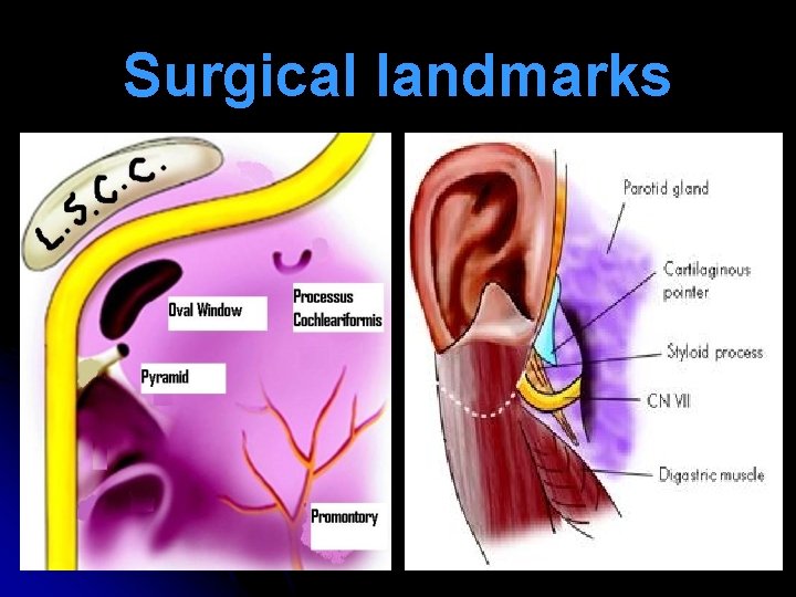 Surgical landmarks 