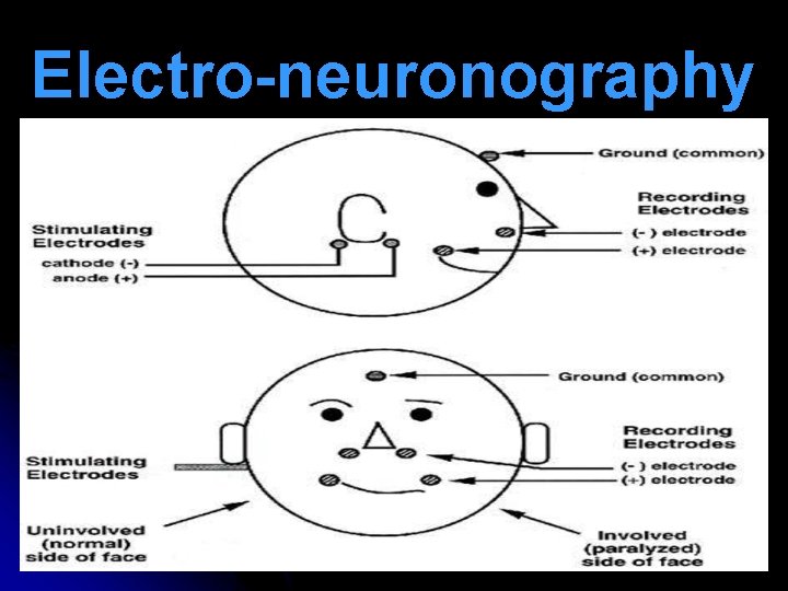 Electro-neuronography 