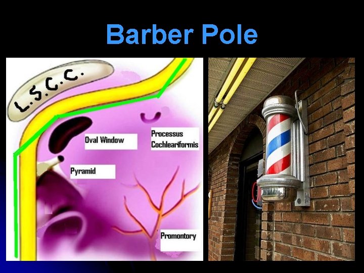 Barber Pole 