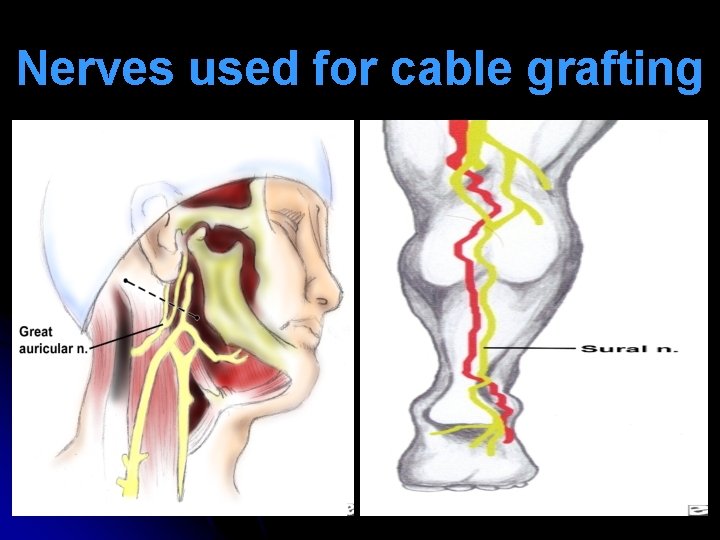 Nerves used for cable grafting 