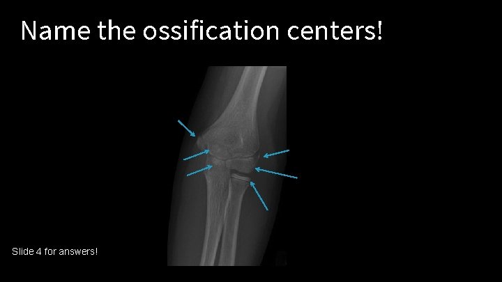 Name the ossification centers! Slide 4 for answers! 