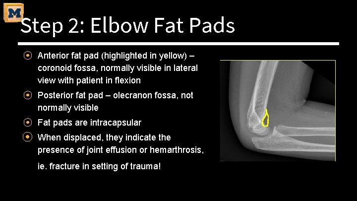 Step 2: Elbow Fat Pads ⦿ Anterior fat pad (highlighted in yellow) – coronoid