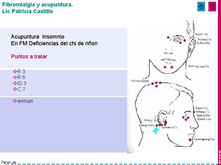 Fibromialgia y acupuntura. Lic Patricia Castillo Mes 1 y 2 Acupuntura insomnio En FM