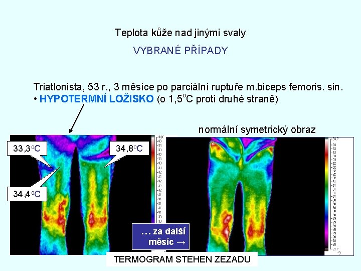 Teplota kůže nad jinými svaly VYBRANÉ PŘÍPADY Triatlonista, 53 r. , 3 měsíce po