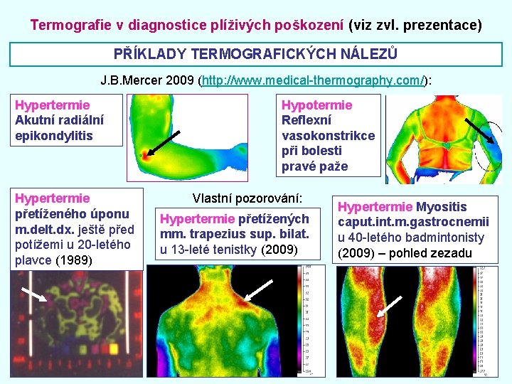 Termografie v diagnostice plíživých poškození (viz zvl. prezentace) PŘÍKLADY TERMOGRAFICKÝCH NÁLEZŮ J. B. Mercer