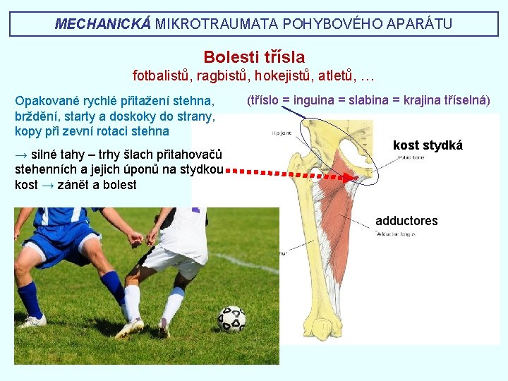 MECHANICKÁ MIKROTRAUMATA POHYBOVÉHO APARÁTU Bolesti třísla fotbalistů, ragbistů, hokejistů, atletů, … Opakované rychlé přitažení