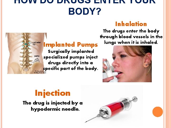 HOW DO DRUGS ENTER YOUR BODY? Inhalation Implanted Pumps Surgically implanted specialized pumps inject