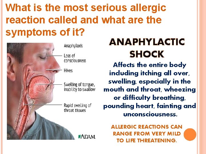 What is the most serious allergic reaction called and what are the symptoms of