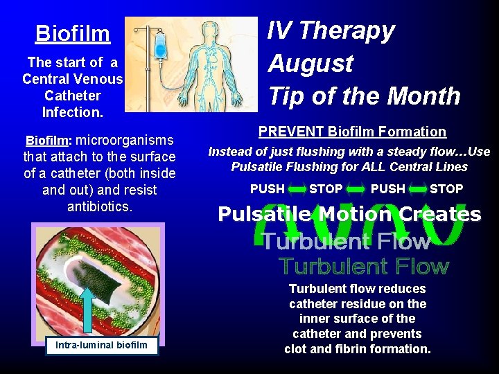 Biofilm The start of a Central Venous Catheter Infection. Biofilm: microorganisms that attach to