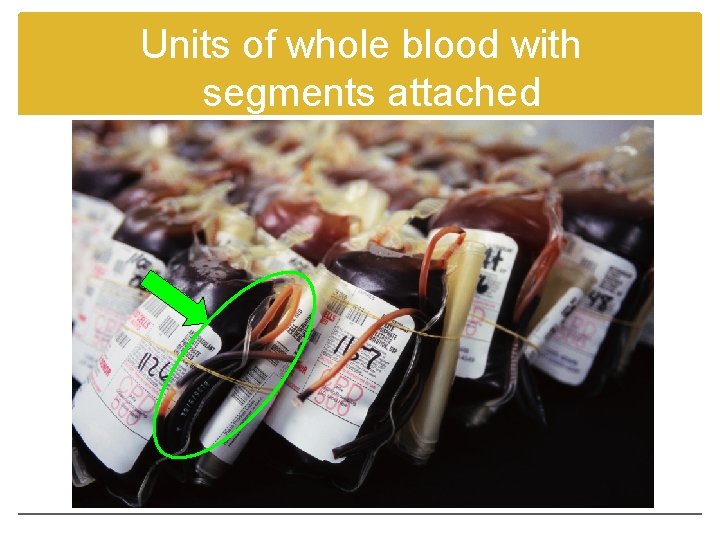 Units of whole blood with segments attached 