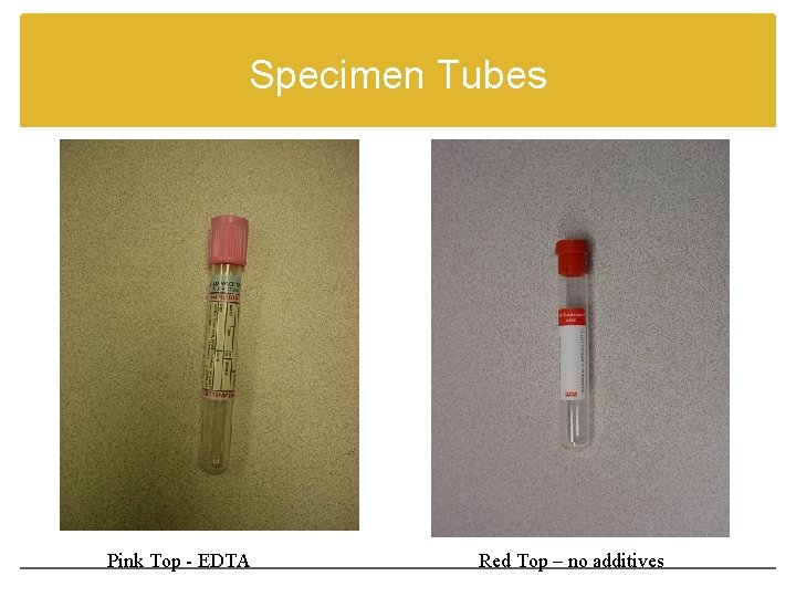 Specimen Tubes Pink Top - EDTA Red Top – no additives 