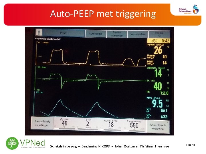 Auto-PEEP met triggering Schakels in de zorg – Beademing bij COPD – Johan Oostom