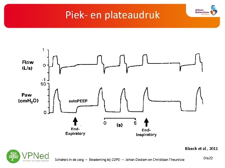 Piek- en plateaudruk Blanch et al. , 2011 Schakels in de zorg – Beademing