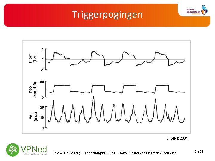 Triggerpogingen J. Beck 2004 Schakels in de zorg – Beademing bij COPD – Johan
