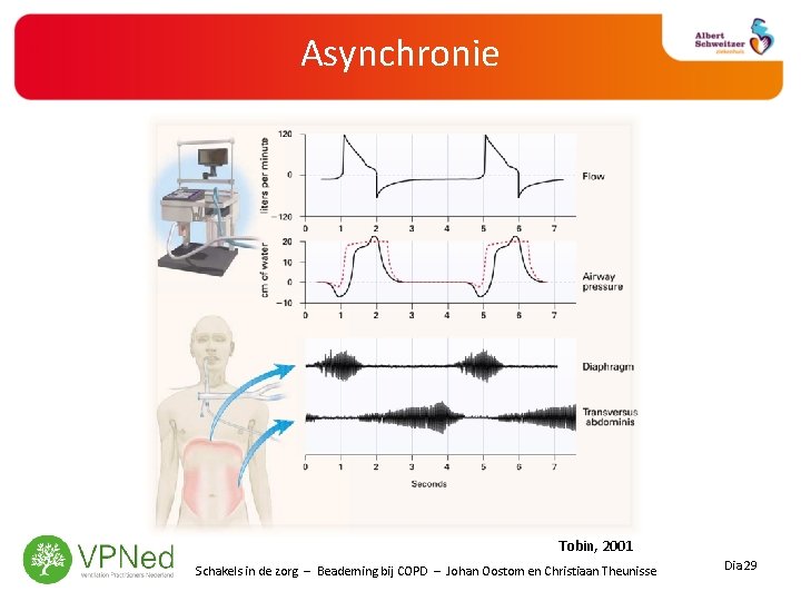 Asynchronie Tobin, 2001 Schakels in de zorg – Beademing bij COPD – Johan Oostom