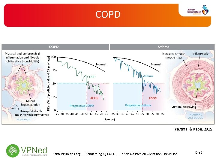 COPD Postma, & Rabe, 2015 Schakels in de zorg – Beademing bij COPD –