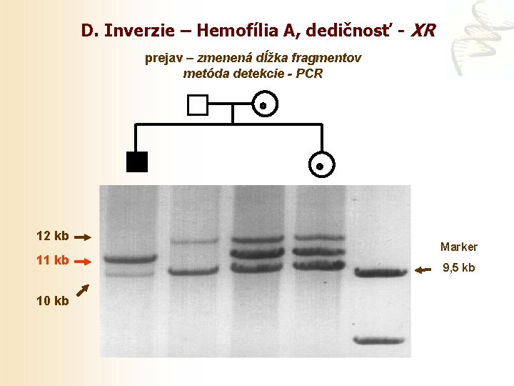 D. Inverzie – Hemofília A, dedičnosť - XR prejav – zmenená dĺžka fragmentov metóda