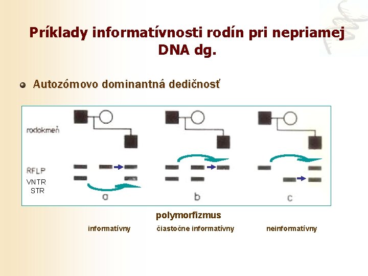 Príklady informatívnosti rodín pri nepriamej DNA dg. Autozómovo dominantná dedičnosť VNTR STR polymorfizmus informatívny