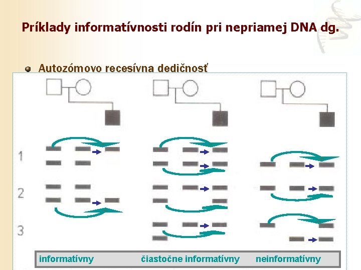 Príklady informatívnosti rodín pri nepriamej DNA dg. Autozómovo recesívna dedičnosť informatívny čiastočne informatívny neinformatívny