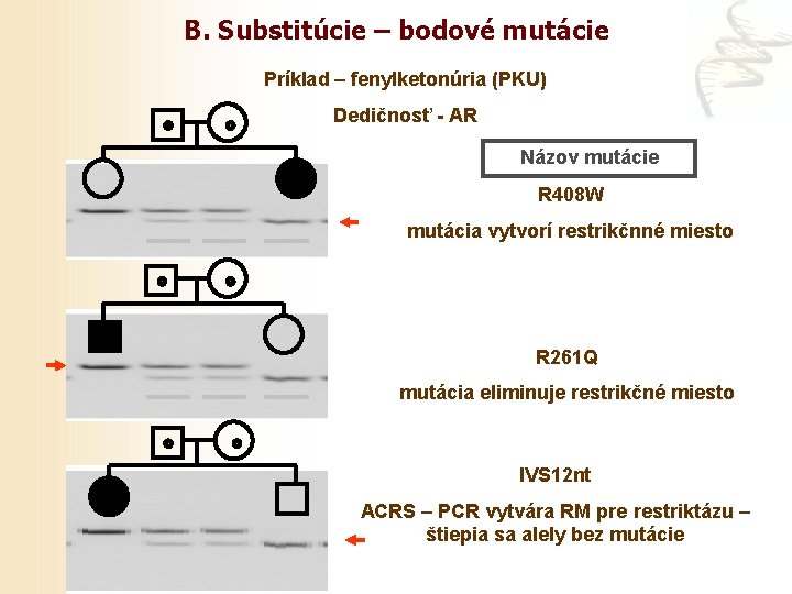 B. Substitúcie – bodové mutácie Príklad – fenylketonúria (PKU) Dedičnosť - AR Názov mutácie