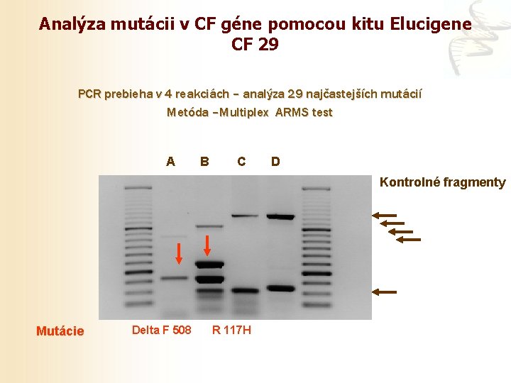 Analýza mutácii v CF géne pomocou kitu Elucigene CF 29 PCR prebieha v 4